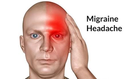 How to Cure Migraine by Herbal Medicines