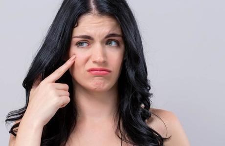 5 Practical Ways to Fade Blemishes on the Skin