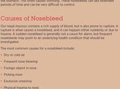 Nosebleed: Characteristics, Causes Treatment