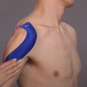 KT Tape Shoulder: Facts You Need to Know!