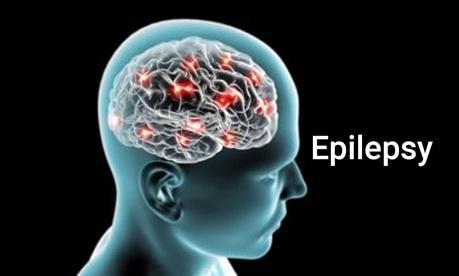 How to Cure Epilepsy by Herbal Medicines