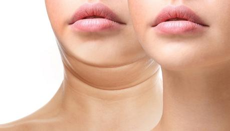 Hating Your Double Chin? Time To Say Goodbye To It