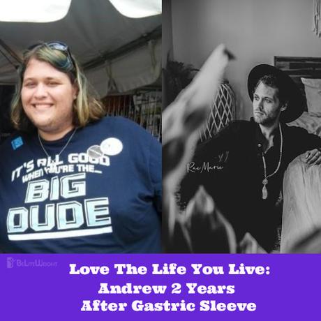 Andrew 2 Years After Gastric Sleeve