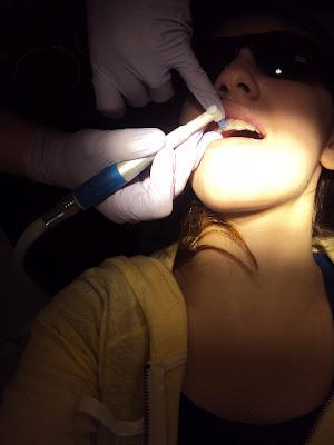 Taking Off My Braces