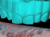 Forensic Dentistry: Bite Marks