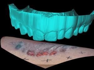 Guest Blogger: Jennifer Vishnevsky: Forensic Dentistry: Bite Marks