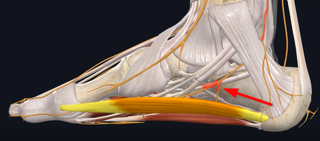 medial nerve position in Baxter's Neuropathy