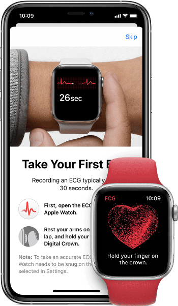 Apple Watch ECG App