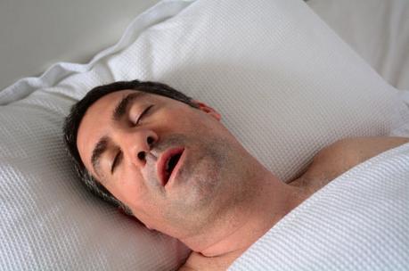 Can You Die from Sleep Apnea?