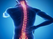 Natural Remedies Arachnoiditis