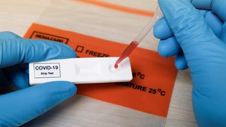 UK government plans to buy 1 million home coronavirus tests