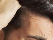 Care Your Hair After Transplant?