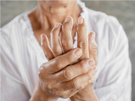 Treatment of Rheumatoid Arthritis through Ayurveda