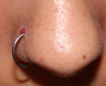 Nose Piercing Bump: 6 Causes and How To Treat Them