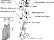 Tibial Nerve Injury: Symptoms, Diagnosis, Treatment Options