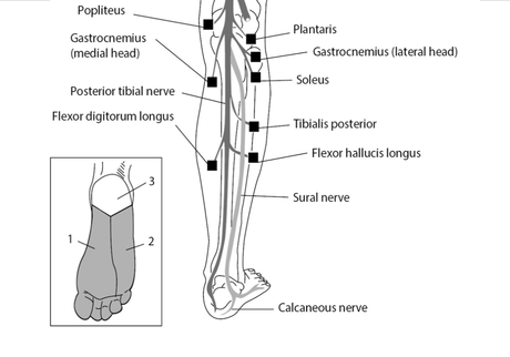 Tibial Nerve Injury: Symptoms, Diagnosis, and Treatment Options - Paperblog