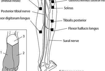 Tibial Nerve Injury: Symptoms, Diagnosis, and Treatment Options - Paperblog