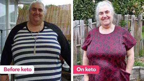 Family loses 300 pounds together in one year on low carb