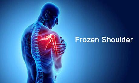 Frozen Shoulder: Kandhe ki akdan