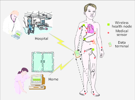 Healthcare monitoring system- Best IoT Project ideas