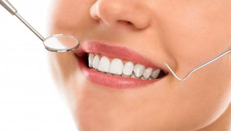 Impacted Wisdom Tooth