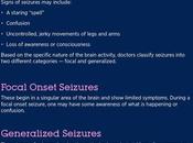 Epilepsy: Symptoms, Causes Treatment
