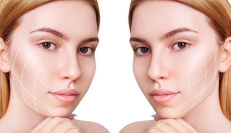 Kybella treatment - Skin Care - Health Guest Posts - Write For us