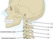 Life After Three Level Cervical Fusion Surgery: Complications Need Know!