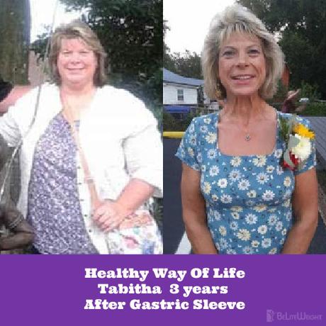 Healthy Way Of Life:Tabitha 3 years After Gastric Sleeve