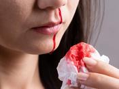 Herbal Remedies Glanzmann’s Thrombasthenia Bleeding Disorder