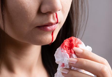 Herbal Remedies for Glanzmann’s Thrombasthenia – Bleeding Disorder