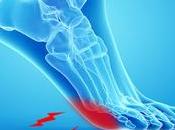 Numbness Pain Ball Your Foot? Steps Treat Neuromas Naturally