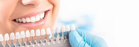 5 Ways to Achieve Pearly White Teeth