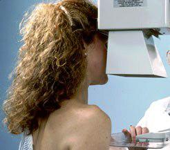 mammograms
