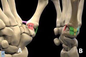 CMC Joint Anatomy and the Sources of CMC Joint Pain: A Must Read Summary