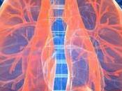 Home Remedies Bronchitis