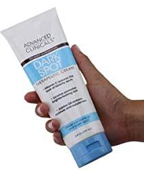 Best Cream to Remove Dark Spots on Hands 2021