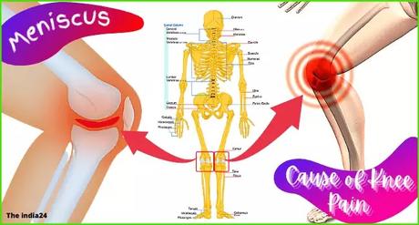 How to avoid knee pain in winter.
