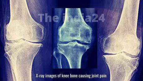 How to avoid knee pain in winter