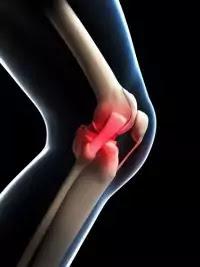 How to avoid knee pain in winter.
