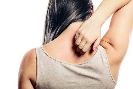 Home Remedies for Skin Allergies