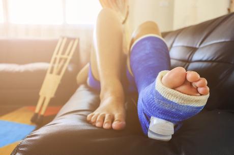 Home Remedies to Heal Fracture