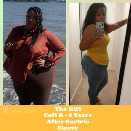The Gift Cofi B – 2 Years After Gastric Sleeve