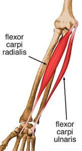 Tendonitis vs Carpal Tunnel: Identifying Important Differences