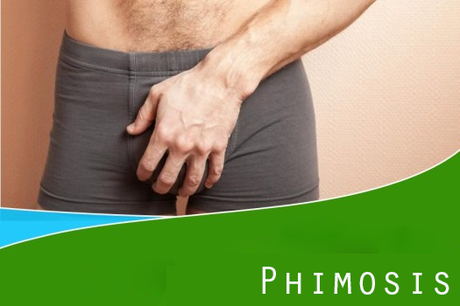 Ayurvedic Treatment of Phimosis