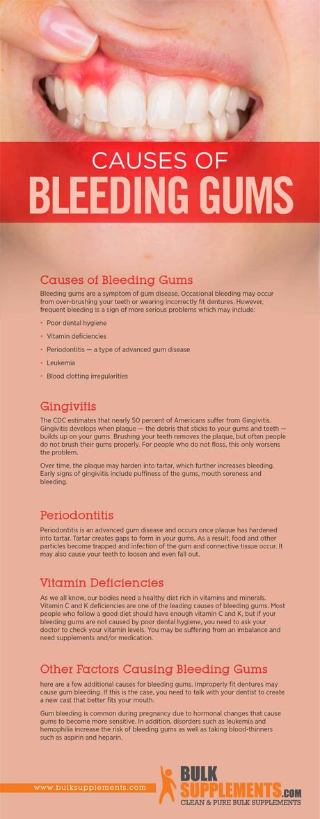 Bleeding Gums: Characteristics, Causes & Treatment - Paperblog