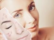 Different Types Clay Mask Benefits