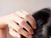 Types Hair Loss Must Know About