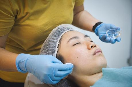 New Generation Chemical Peel in Singapore Review