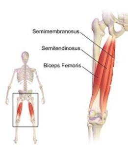 Biceps Femoris Tendonitis Stem Cell Treatment: AKA Hamstring Treatment Options